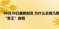 06月30日最新时讯 为什么总有几根头发又粗又硬又卷 揭秘“发王”真相