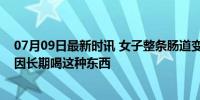 07月09日最新时讯 女子整条肠道变黑，长满“豹纹”，只因长期喝这种东西