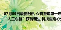 07月09日最新时讯 心衰至奄奄一息 他植入了一枚全球最小“人工心脏”获得新生 科技重启心生希望