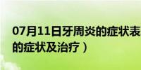 07月11日牙周炎的症状表现与治疗（牙周炎的症状及治疗）