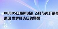 08月05日最新时讯 乙肝与丙肝是导致肝硬化和肝癌的主要原因 世界肝炎日的警醒